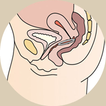 L'anneau vaginal contraceptif : Nuvaring®