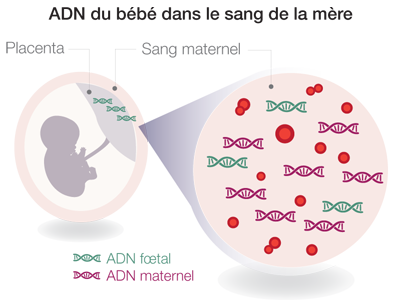 dpni