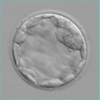 Infertilite FIV11