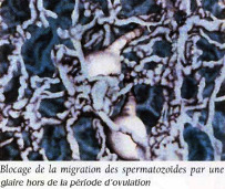 glaire cervicale patho 2