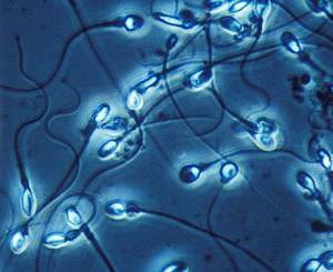 spermatozoides fragmentation