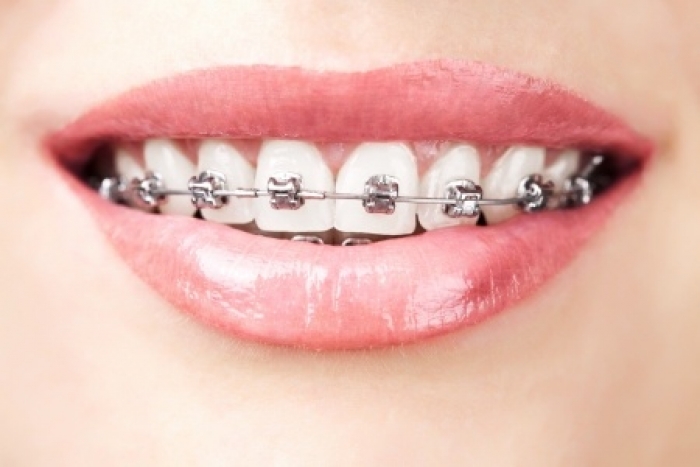 Prenez soin de vos dents